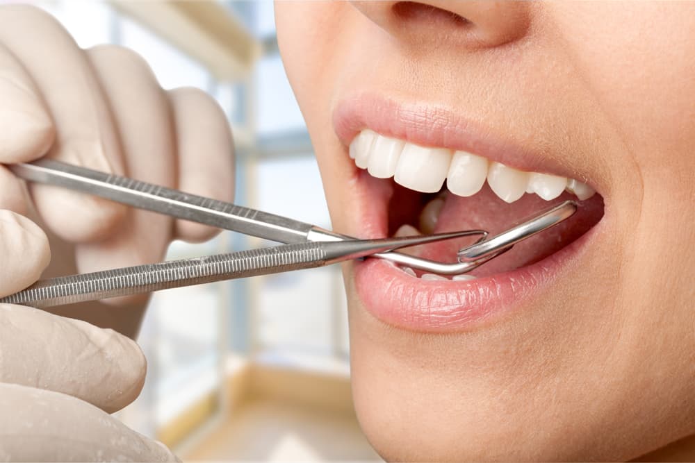 Implantes de dientes en Santiago de Compostela