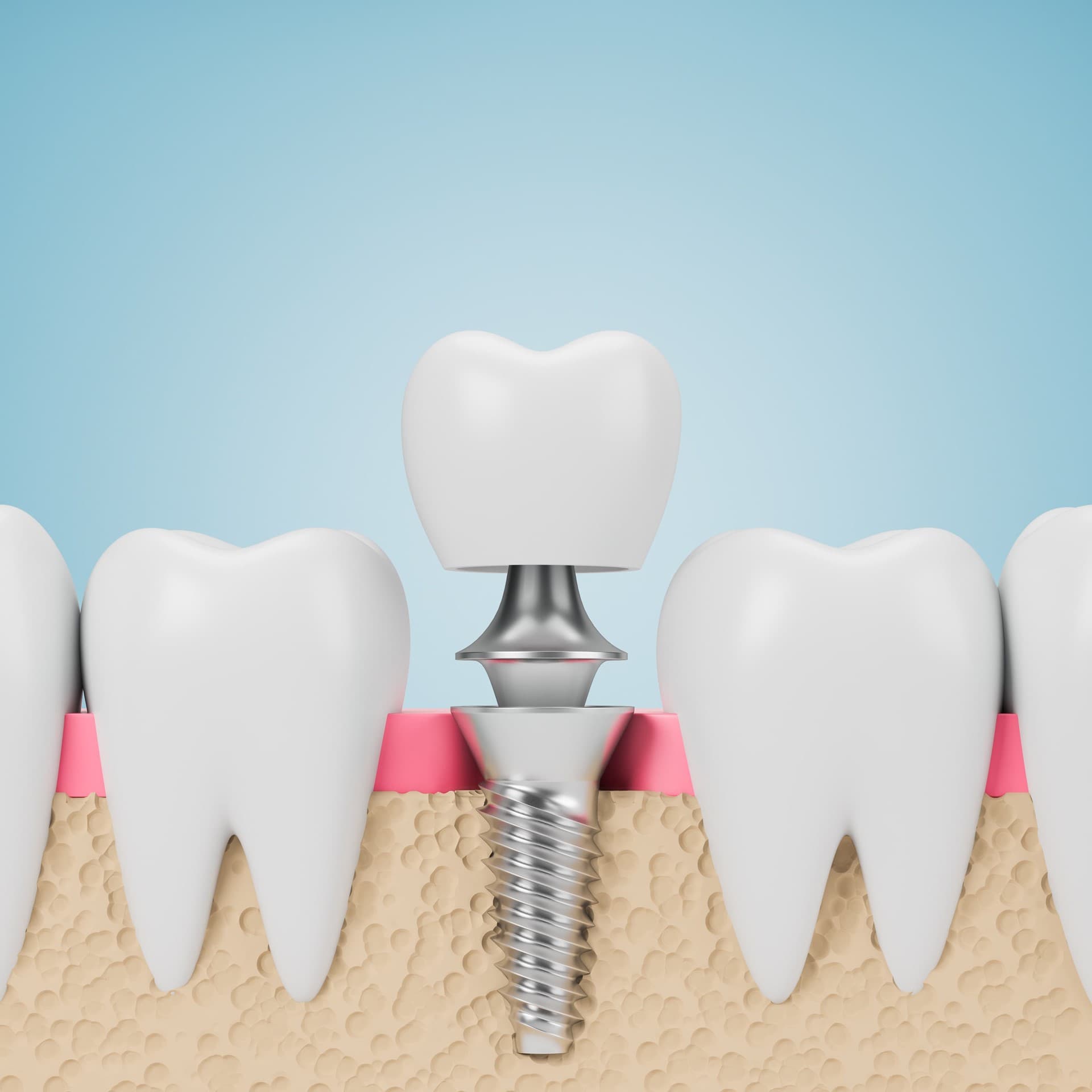 Clínica dental en Santiago